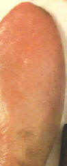 Lengua de ternera