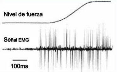 Registros de la actividad eléctrica asociada con los músculos (actividad electromiográfica).