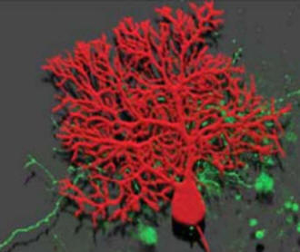 Una célula de Purkinje del cerebelo mostrando la extensa arborización de su árbol dendrítico. Este árbol les sirve para recibir la miríada de impulsos que se requieren para la sincronización de los movimientos precisos que aprendemos.